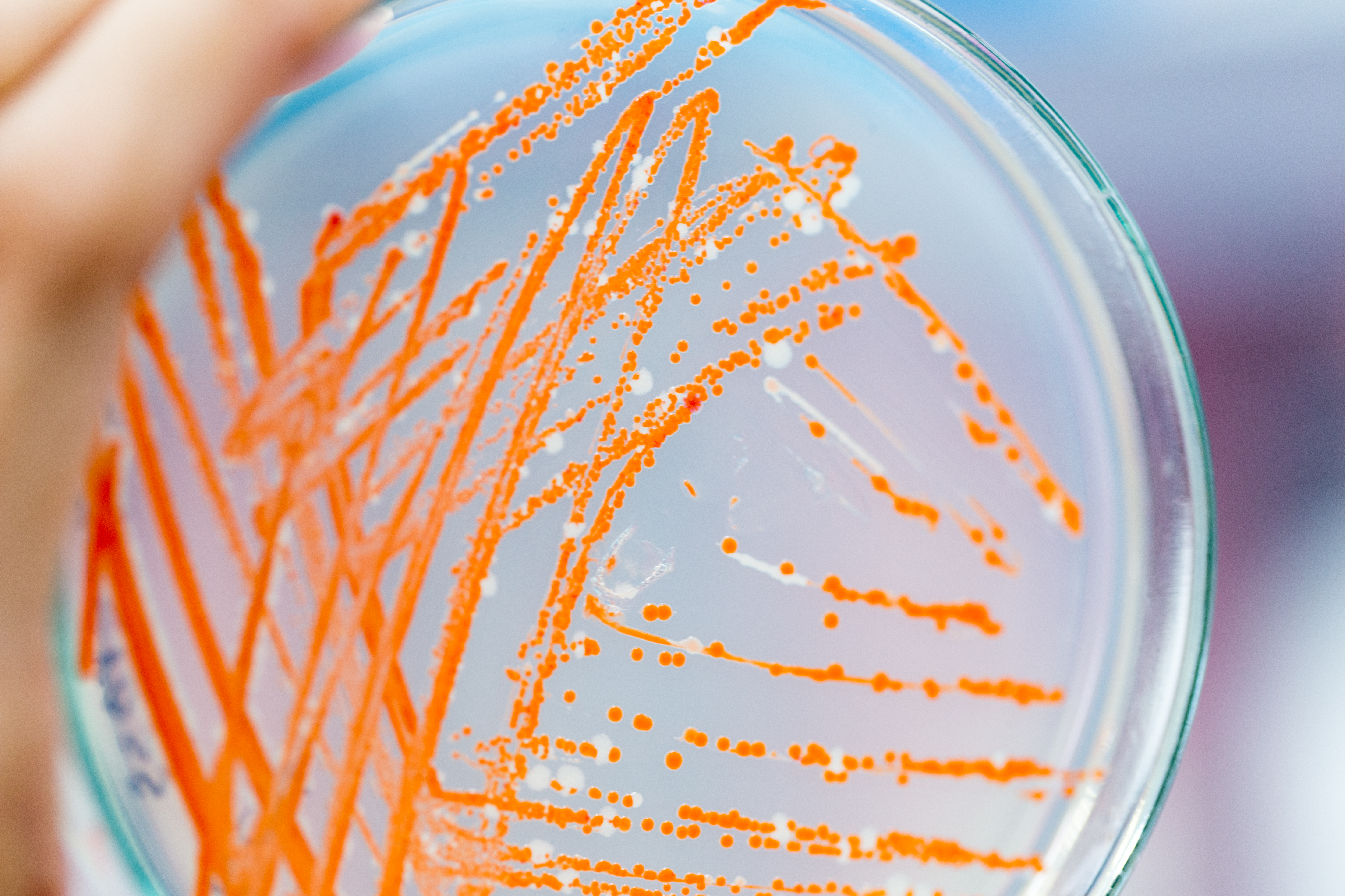 CFU count in Bacteria Culture