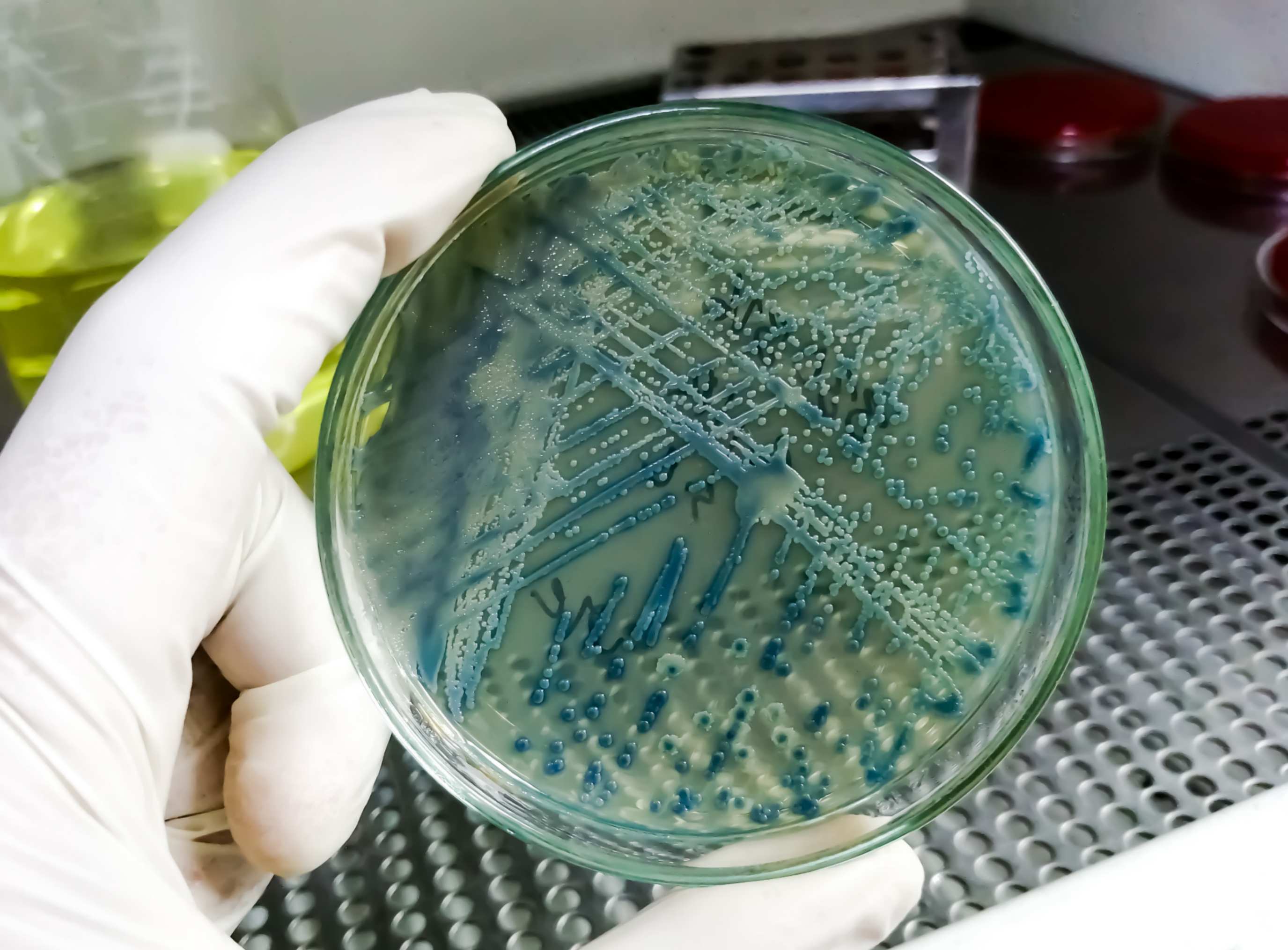 jpeg optimizer closeup bacteria culture growth selective media plate microbiology laboratory